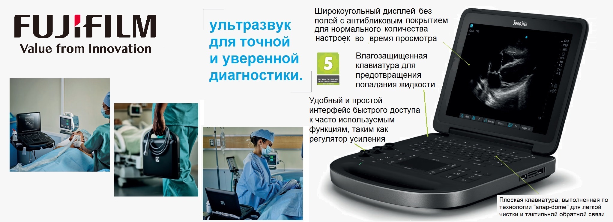 Ультразвуковая система SonoSite Edge II
